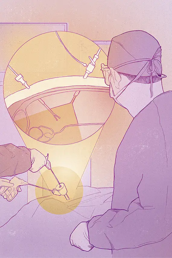 Cirugía laparoscópica: alta precisión y excelentes resultados