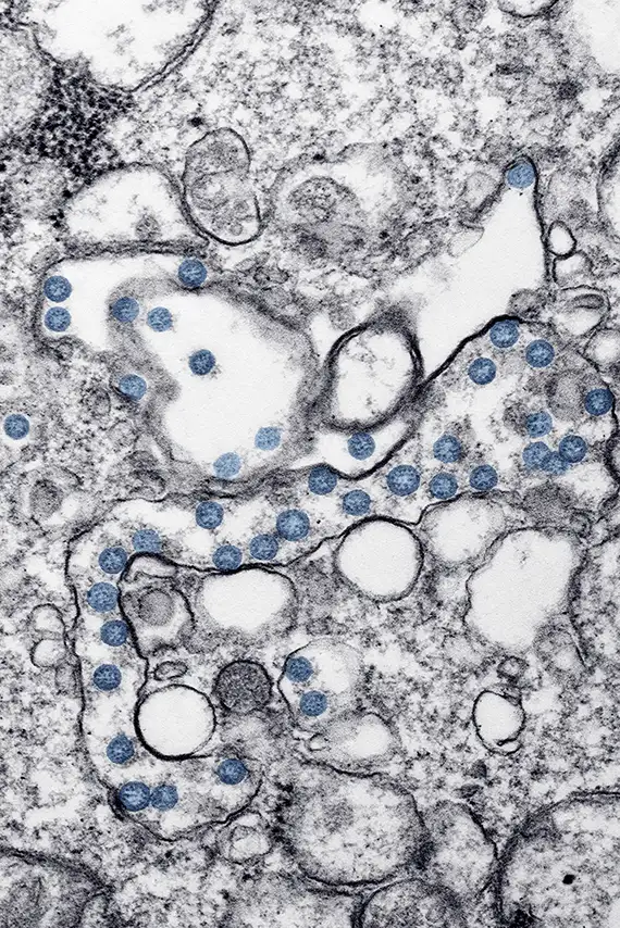 ABC del hantavirus: lo que se sabe y cuál es el riesgo real