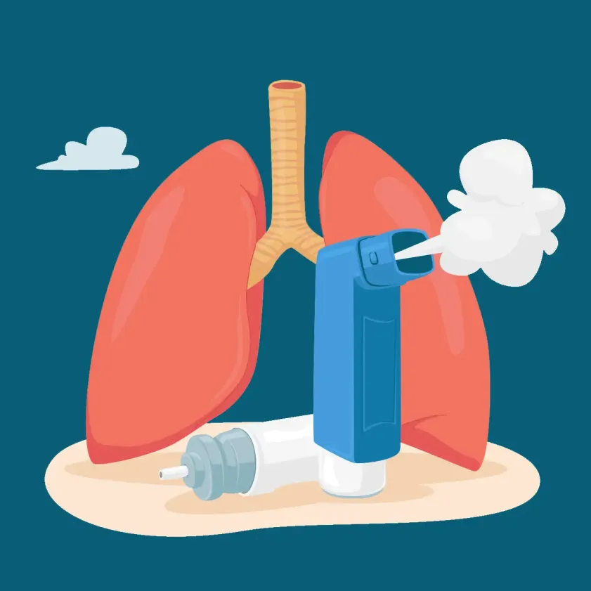 Inhaladores: aliados en el tratamiento del asma y la EPOC