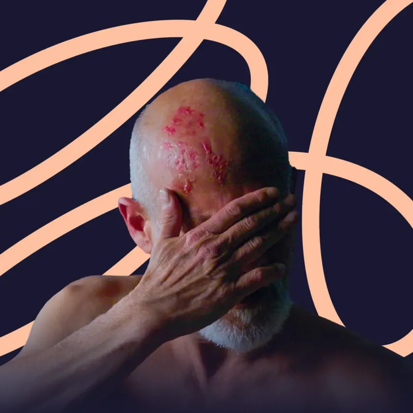¿Tienes 50 años o más? El 99% de los adultos en esta edad está en riesgo de desarrollar herpes zóster o culebrilla