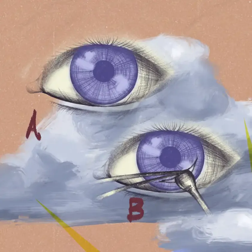 Trasplante de córnea: cómo recuperar la visión y la calidad de vida