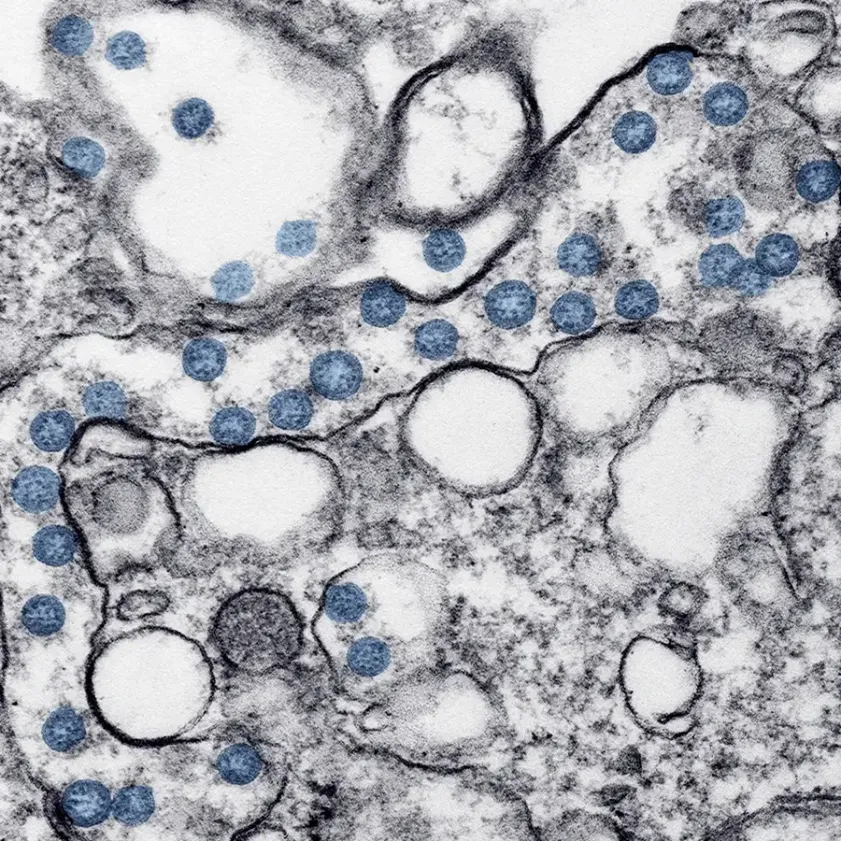 ABC del hantavirus: lo que se sabe y cuál es el riesgo real