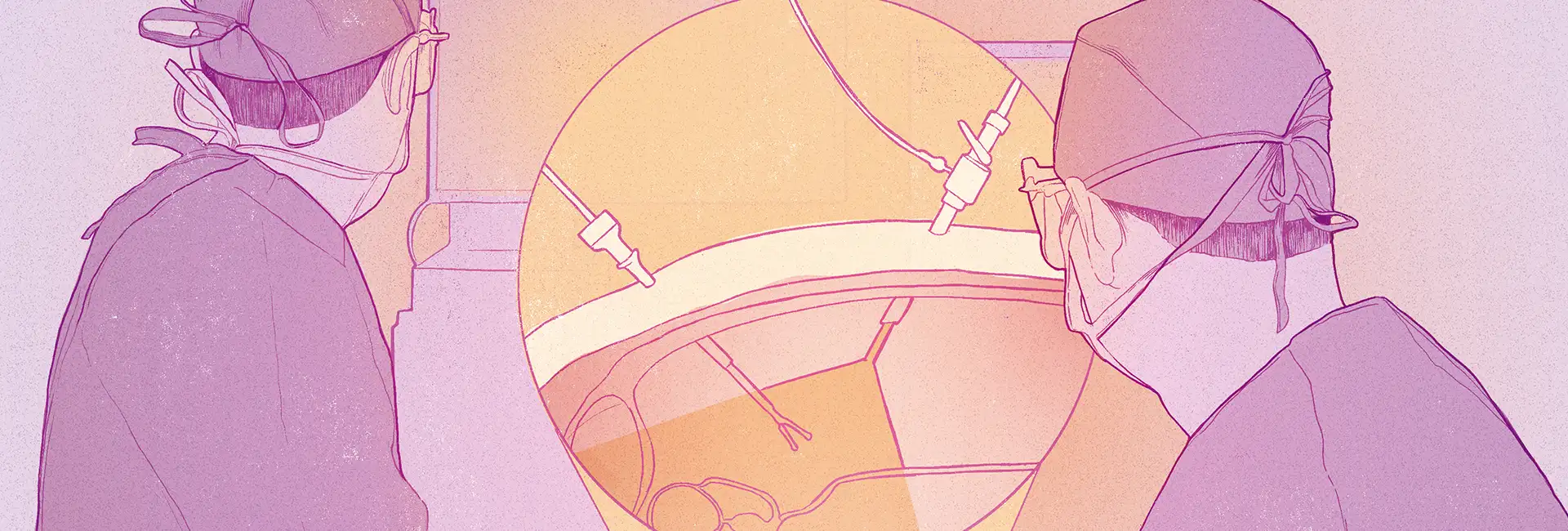 Cirugía laparoscópica