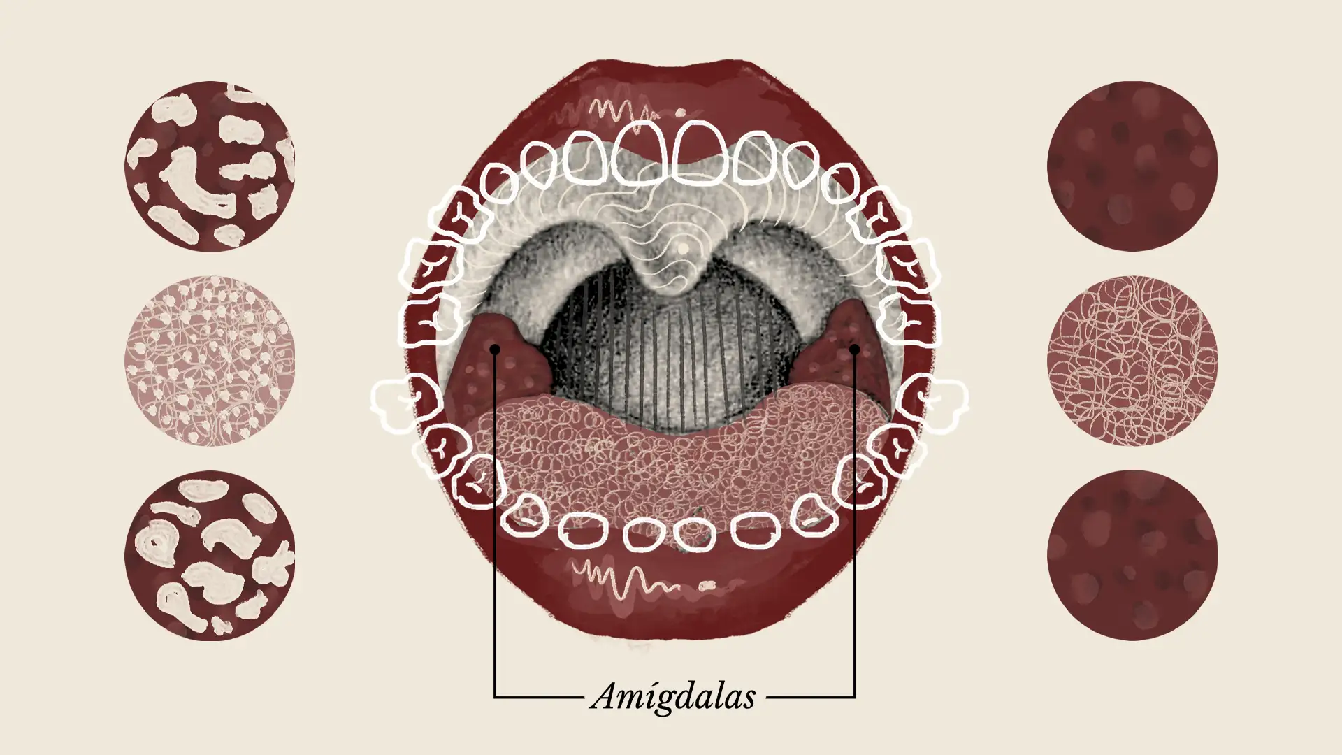 amígdalas