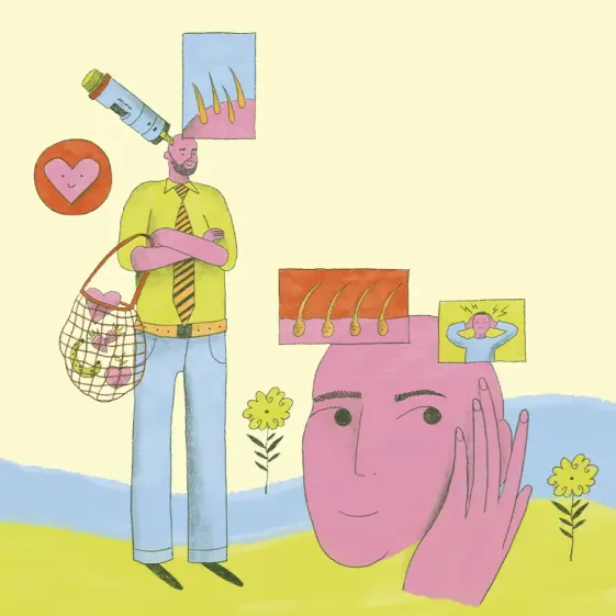 cómo prevenir la calvicie