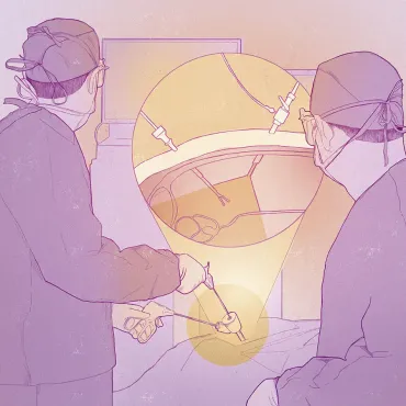 Cirugía laparoscópica