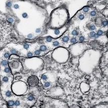 hantavirus