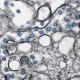hantavirus