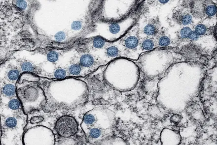 hantavirus